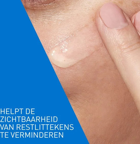 CeraVe Anti-Onzuiverheden Retinol Serum - tegen Vlekjes en Restlittekens - voor een Onzuivere Huid met Neiging tot Acne - 30ml